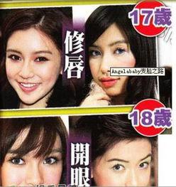 西安整容爆料事件视频最新,揭秘行业乱象，患者权益引关注  第2张